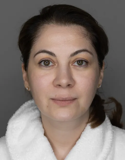 7D-rejuvenation Thermolifting Oligio