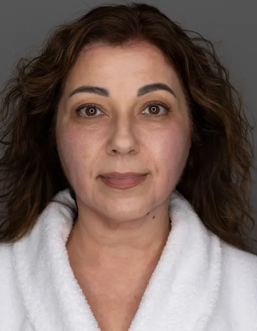 7D-rejuvenation Thermolifting Oligio