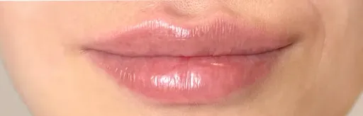 Contour plastic