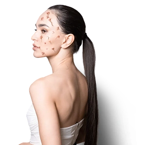 7D-rejuvenation Thermolifting Oligio