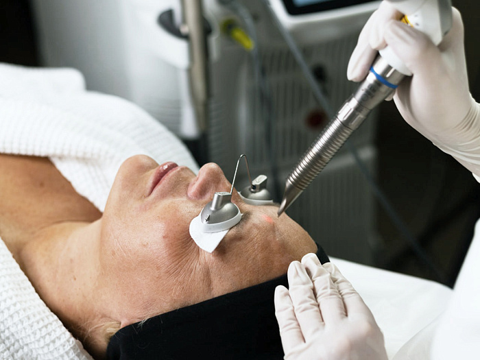 Процедура омоложение FOTONA в Москве