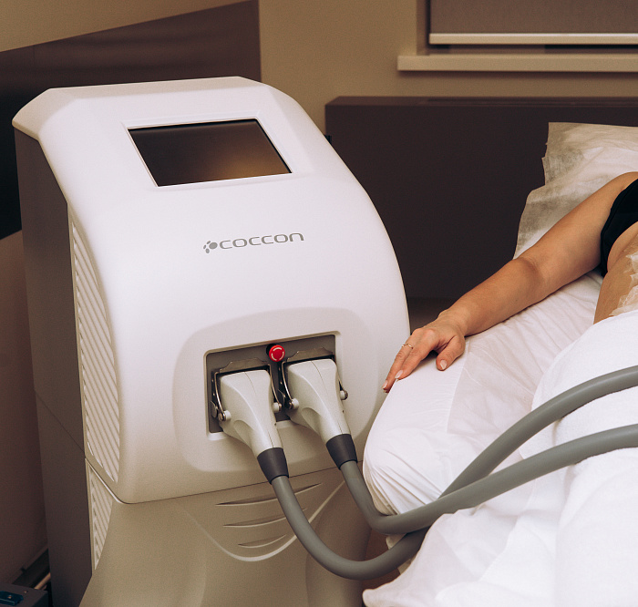 Rehabilitation after cryomodeling