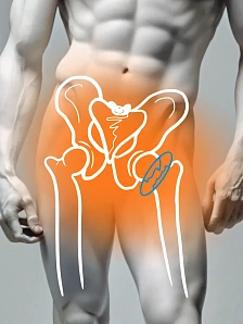 Лечение переломов шейки бедра