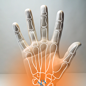 Arthroscopic revision of the cystic joint