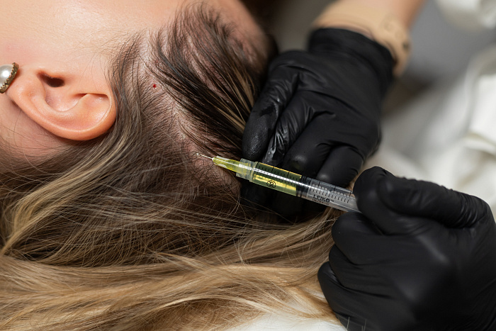 Процедура Плазмолифтинг, PRP-терапия в Москве