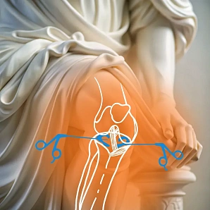 Arthroscopy of the knee joint