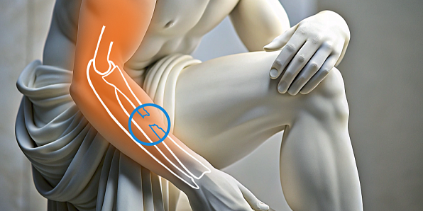 Лечение переломов лучевой кости