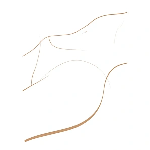 Перинеопластика