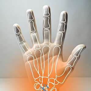 Артроскопическая ревизия кистевого сустава