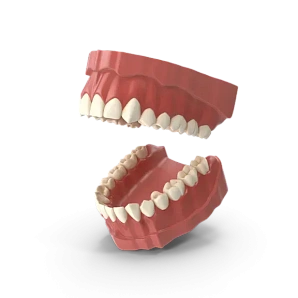 Prostheses on implants