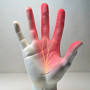 Лечение туннельного синдрома