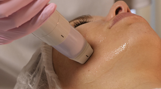 Монополярный RF-лифтинг на аппарате Volnewmer