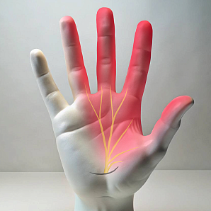 Tunnel syndrome treatment