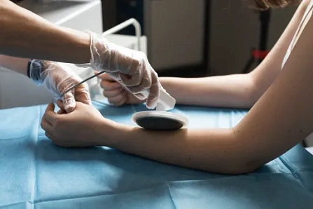 Низкочастотная электростатическая терапия