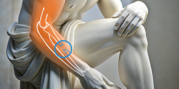 Лечение переломов предплечья