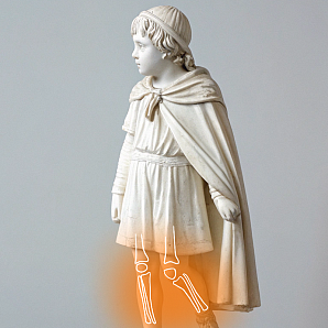 МРТ опорно-двигательного аппарата у детей