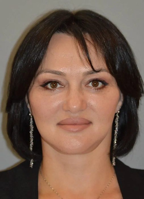 Smas-лифтинг, Платизмопластика