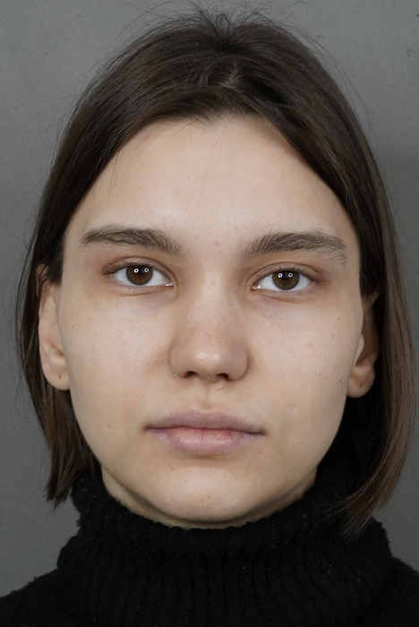Пьезоринопластика